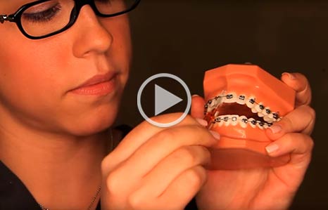 Wearing Braces The Orthodontic Studio Chevy Chase MD