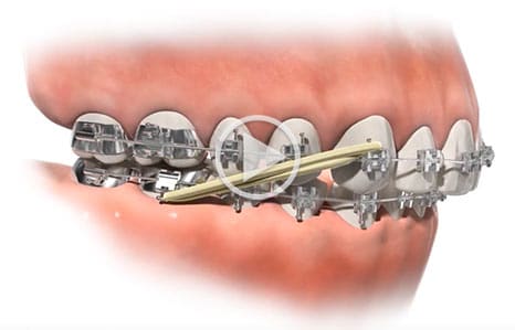 Video Southern Maine Orthodontics in Scarborough, ME