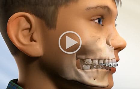 Video at Southern Maine Orthodontics in Scarborough, ME