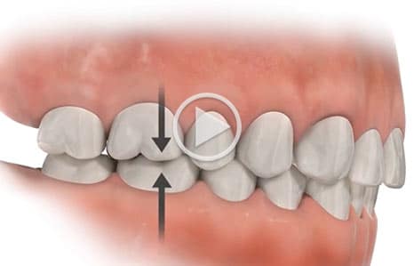 Video at Southern Maine Orthodontics in Scarborough, ME