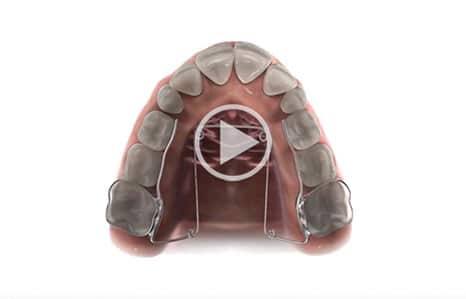Video at Southern Maine Orthodontics in Scarborough, ME