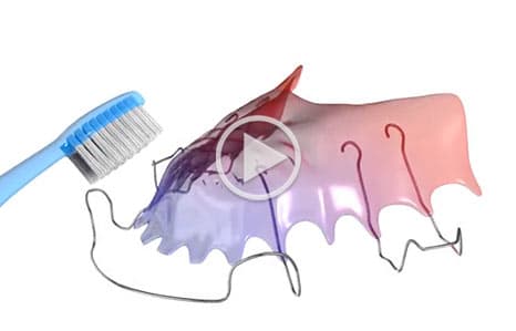 Retainer at Southern Maine Orthodontics in Scarborough, ME
