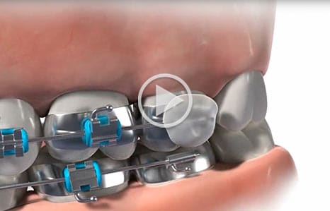 Video at Southern Maine Orthodontics in Scarborough, ME