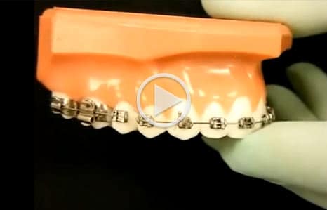 Emergency Care The Orthodontic Studio Chevy Chase MD